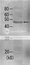 Proteasome 26S Subunit, Non-ATPase 8 antibody, 62-209, BioAcademia Inc, Western Blot image 