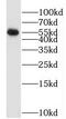 SWI/SNF Related, Matrix Associated, Actin Dependent Regulator Of Chromatin, Subfamily D, Member 3 antibody, FNab08013, FineTest, Western Blot image 