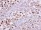 Karyopherin Subunit Alpha 2 antibody, NBP1-31098, Novus Biologicals, Immunohistochemistry paraffin image 