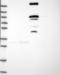 DNA Damage Induced Apoptosis Suppressor antibody, NBP1-82058, Novus Biologicals, Western Blot image 
