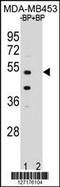 POC1 Centriolar Protein B antibody, 55-562, ProSci, Western Blot image 