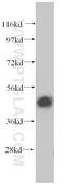 Proteasome 26S Subunit, ATPase 2 antibody, 14905-1-AP, Proteintech Group, Western Blot image 
