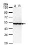 Serine/Threonine Kinase 40 antibody, TA308180, Origene, Western Blot image 