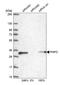 Pyridoxamine 5'-Phosphate Oxidase antibody, HPA027776, Atlas Antibodies, Western Blot image 