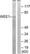 WEE1 G2 Checkpoint Kinase antibody, TA314672, Origene, Western Blot image 