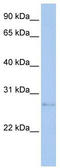 Mdm1 Nuclear Protein antibody, TA338402, Origene, Western Blot image 