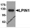 Phosphatidate phosphatase LPIN1 antibody, 7393, ProSci Inc, Western Blot image 