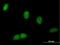 Bromodomain And WD Repeat Domain Containing 1 antibody, H00054014-B01P, Novus Biologicals, Immunofluorescence image 