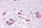 Melanin Concentrating Hormone Receptor 1 antibody, NBP1-02408, Novus Biologicals, Immunohistochemistry frozen image 