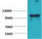 Immunoglobulin Like And Fibronectin Type III Domain Containing 1 antibody, A14038, Boster Biological Technology, Western Blot image 