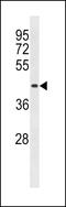 Breast cancer metastasis-suppressor 1 antibody, LS-C157685, Lifespan Biosciences, Western Blot image 