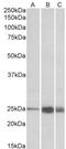 Troponin I2, Fast Skeletal Type antibody, NBP2-26201, Novus Biologicals, Western Blot image 