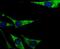 Phosphoenolpyruvate carboxylase antibody, NBP2-75609, Novus Biologicals, Immunofluorescence image 