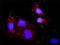 SLP-65 antibody, H00029760-M04, Novus Biologicals, Proximity Ligation Assay image 