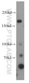 MTK1 antibody, 21610-1-AP, Proteintech Group, Western Blot image 