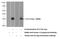 IL-6 antibody, 19831-1-AP, Proteintech Group, Western Blot image 