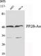 Serine/threonine-protein phosphatase 2B catalytic subunit alpha isoform antibody, A03026-1, Boster Biological Technology, Western Blot image 