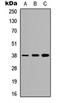 NK2 Homeobox 1 antibody, orb304651, Biorbyt, Western Blot image 