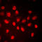 RB Transcriptional Corepressor 1 antibody, LS-C352779, Lifespan Biosciences, Immunofluorescence image 