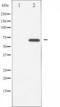LIM Domain Kinase 2 antibody, TA325622, Origene, Western Blot image 