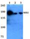Probable G-protein coupled receptor 116 antibody, PA5-75810, Invitrogen Antibodies, Western Blot image 