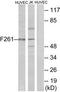 6PF-2-K/Fru-2,6-P2ase 1 antibody, TA314332, Origene, Western Blot image 