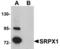 Sushi Repeat Containing Protein X-Linked antibody, TA306869, Origene, Western Blot image 
