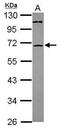 ST6 N-Acetylgalactosaminide Alpha-2,6-Sialyltransferase 1 antibody, PA5-31200, Invitrogen Antibodies, Western Blot image 