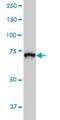 Zinc Finger BED-Type Containing 1 antibody, H00009189-M01, Novus Biologicals, Western Blot image 