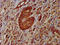 NODAL Modulator 1 antibody, LS-C671745, Lifespan Biosciences, Immunohistochemistry paraffin image 
