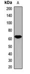 MYCN Proto-Oncogene, BHLH Transcription Factor antibody, orb411610, Biorbyt, Western Blot image 