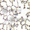 p38 antibody, A0227, ABclonal Technology, Immunohistochemistry paraffin image 