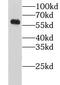 Lysophosphatidylcholine Acyltransferase 4 antibody, FNab04828, FineTest, Western Blot image 