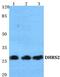 Dehydrogenase/Reductase 2 antibody, PA5-75504, Invitrogen Antibodies, Western Blot image 