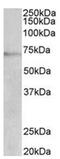 Dopamine Beta-Hydroxylase antibody, AP31950PU-N, Origene, Western Blot image 