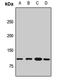 Protocadherin-15 antibody, LS-C668902, Lifespan Biosciences, Western Blot image 