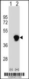 Enoyl-CoA Delta Isomerase 2 antibody, 63-592, ProSci, Western Blot image 