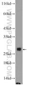 GC-A antibody, 15787-1-AP, Proteintech Group, Western Blot image 