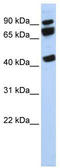 DEAD-Box Helicase 17 antibody, TA341577, Origene, Western Blot image 