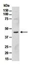Sonic Hedgehog Signaling Molecule antibody, orb66795, Biorbyt, Western Blot image 