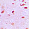 Rap1 GTPase-activating protein 1 antibody, LS-C352756, Lifespan Biosciences, Immunohistochemistry paraffin image 