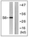 Ribosomal Protein S6 antibody, AP31752PU-N, Origene, Western Blot image 