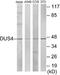 Dual Specificity Phosphatase 4 antibody, EKC1789, Boster Biological Technology, Western Blot image 