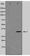 Gap Junction Protein Beta 1 antibody, TA347880, Origene, Western Blot image 