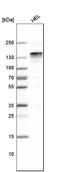 WARTS antibody, HPA031804, Atlas Antibodies, Western Blot image 