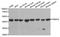 Proteasome 26S Subunit, ATPase 6 antibody, A5377, ABclonal Technology, Western Blot image 