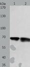 Proteasome 26S Subunit, Non-ATPase 3 antibody, TA321531, Origene, Western Blot image 