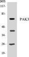 Serine/threonine-protein kinase PAK 3 antibody, LS-C200461, Lifespan Biosciences, Western Blot image 