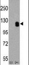 EPH Receptor B2 antibody, MA5-11162, Invitrogen Antibodies, Western Blot image 
