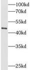 Keratin-16 antibody, FNab02200, FineTest, Western Blot image 